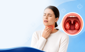 Strep Throat